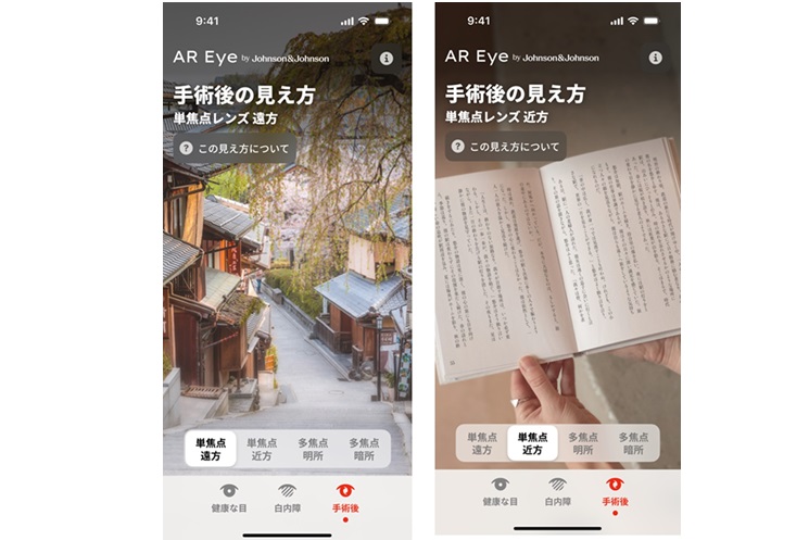 単焦点眼内レンズの見え方イメージ（左：遠方にピントを合わせた場合、右：近方にピントを合わせた場合）