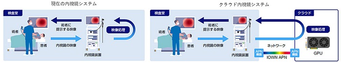 ラウド内視鏡システムの概要