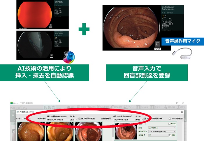 「Ver2.0」の検査時間記録機能の概要