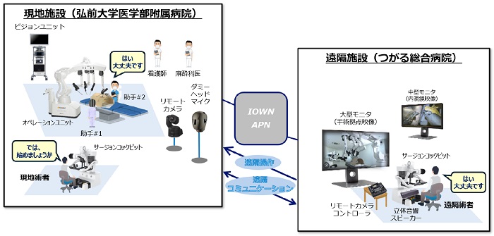 「IOWN APN」を使った遠隔手術支援の構成イメージ