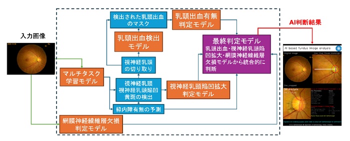 緑内障診断AIのアルゴリズム