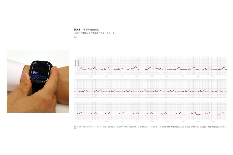 AppleWatchでの心電図計測・計測した心電図をPDFで表示