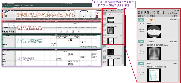 「参照支援サジェストAI機能」のユーザーインターフェース(左)。検査画像や文書など、医療従事者が参照する可能性が高いデータ(右)をリスト表示する