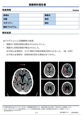 「DoctorNET Heuron CTS」のレポートフォーマット（上：高吸収領域の検出時、下：低吸収領域の検出時）
