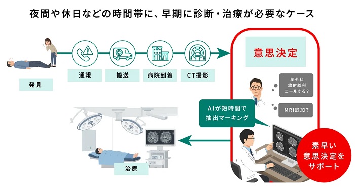 医療現場での「頭部CT画像解析AIエンジン DoctorNET Heuron CTS」の活用イメージ