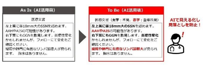 AI活用による医療文書の重要所見判定イメージ