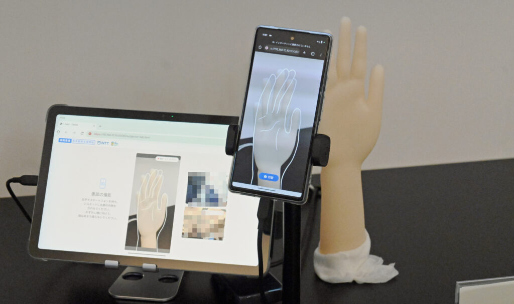 スマホに表示されるガイドラインに沿って患部を撮影する