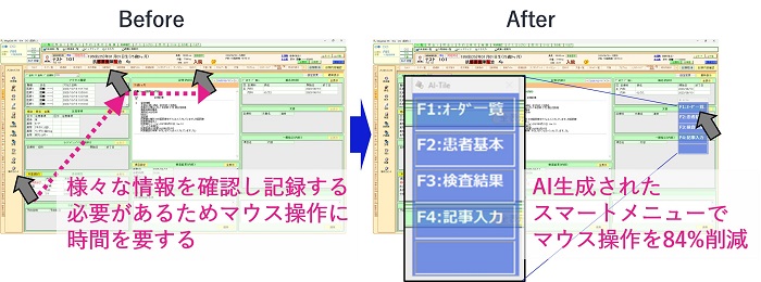 電子カルテの画面上にタイル形式で表示した次の操作候補イメージ