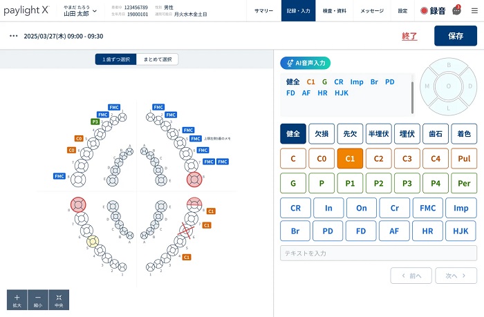 「歯式のAI音声入力(β版)/歯式の一括入力」の画面イメージ