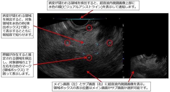 超音波内視鏡検査の支援イメージ