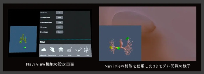 Navi view機能のイメージ