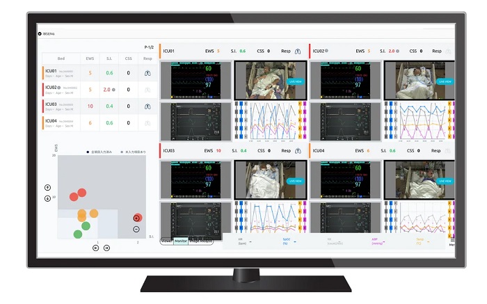生体看視アプリケーション「iBSEN DX(イプセンディーエックス)」