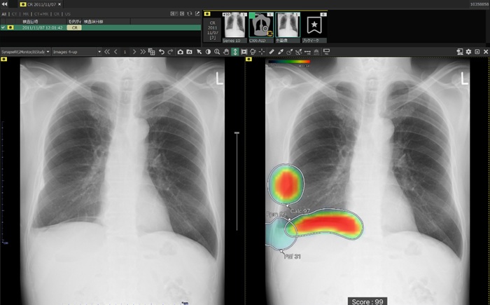 （左）オリジナル画像、（右）解析画像