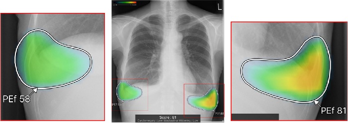 所見名とスコア表示