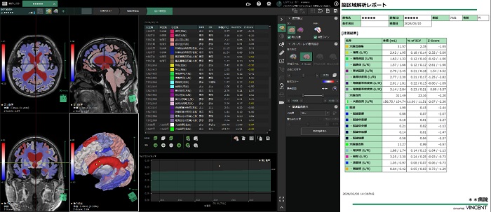 正常脳との比較定量化画面とレポート