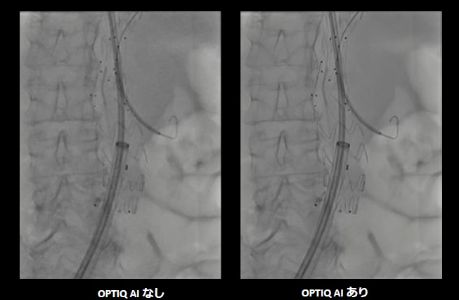 「OPTIQ AI」の使用あり・なしでの画像イメージ