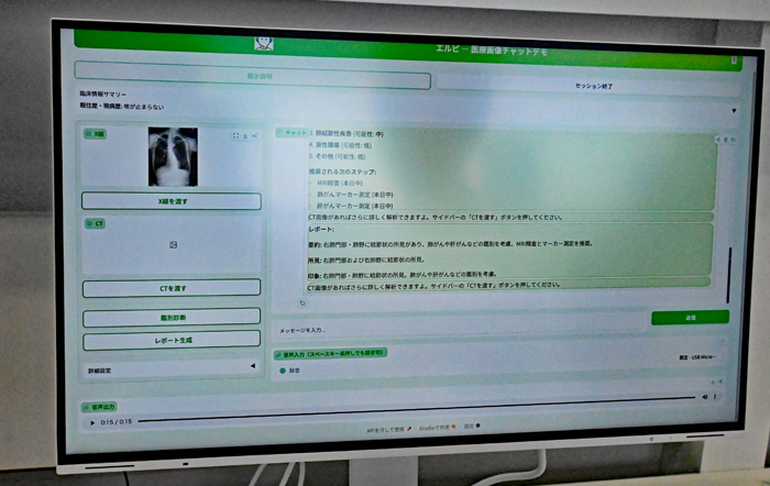 コンセプト展示したAI医師の画面