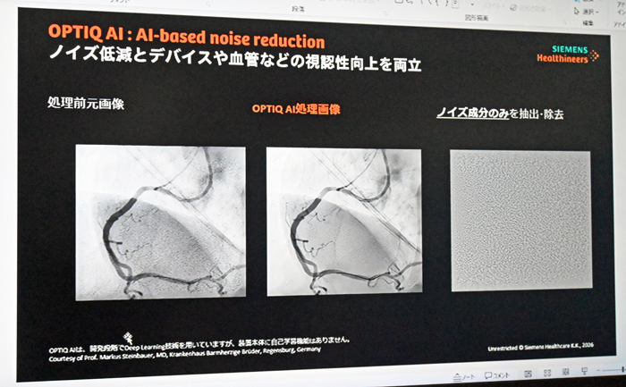 左から）「OPTIQ AI」のなし・ありの画像イメージ比較