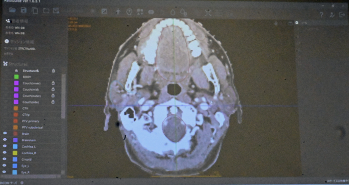 「RatoGuide」の画面イメージ。