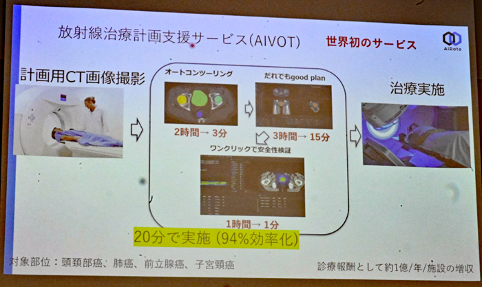 AIが輪郭抽出や照射領域の決定、安全性検証を支援し、計画作成を約20分に短縮する
