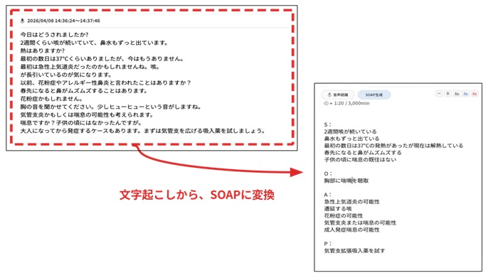 「音声認識＆SOAP生成機能」の画面イメージ