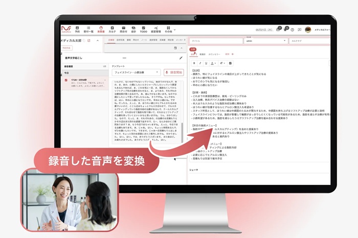 「AI音声カルテ」の機能イメージ