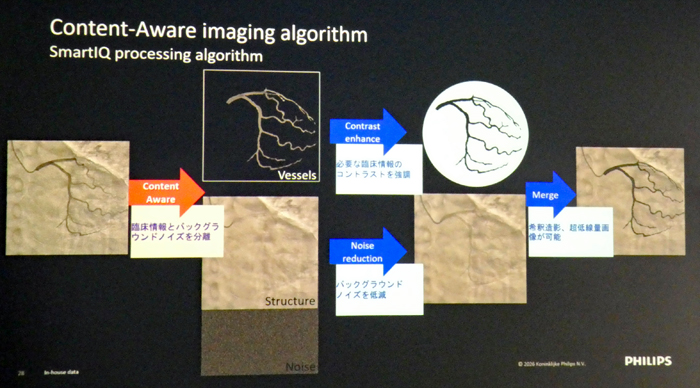 「Content-Aware imaging algorithm」の画像処理フロー