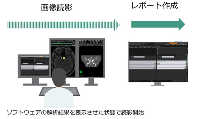 「コンカレントリード型」の読影ワークフロー