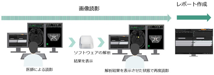 「セカンドリード型」の読影ワークフロー
