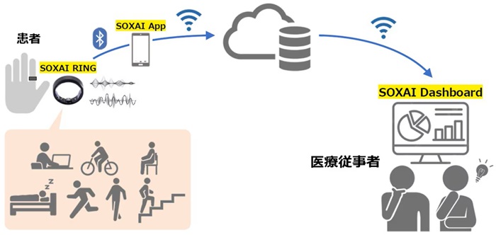 スマートリングを活用した術後患者の経過観察実証のイメージ