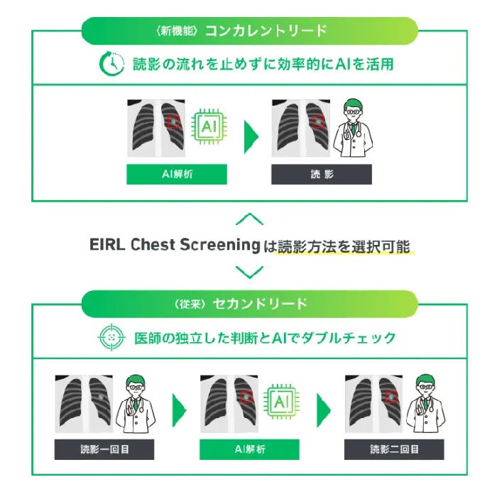 「コンカレントリード」と「セカンドリード」の概要