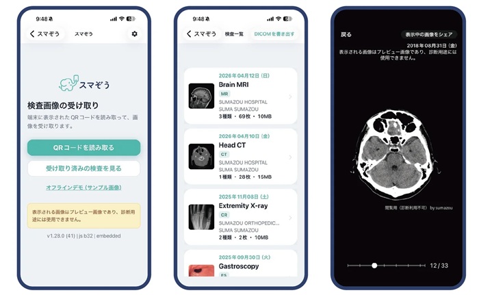 (左から)「スマぞう」アプリのトップ画面・検査一覧・画像閲覧画面