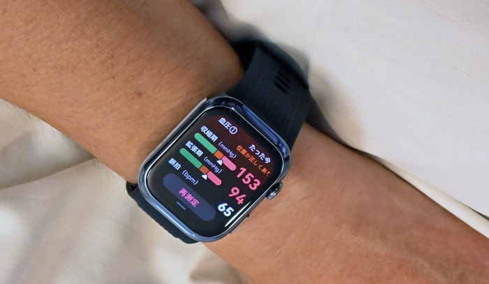 患者が装着するファーウェイ製のスマートウオッチ